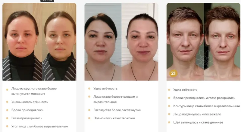 Скачать курс «[Международная Академия фейспластики и остеопатии] Отекам Нет. Январь 2022 (Алесь Улищенко)» — слив курса