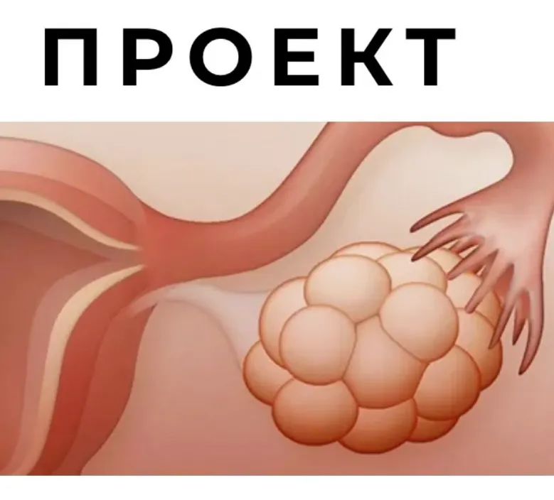 Скачать курс «Спкя и другие нарушения менструального цикла (Гала Гарбузова)» — слив курса