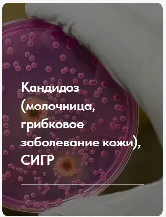 Скачать курс «Лечебный протокол Кандидоз: молочница, грибковое заболевание кожи, сигр. Тариф без обратной связи (Елена Ержанова)» — слив курса