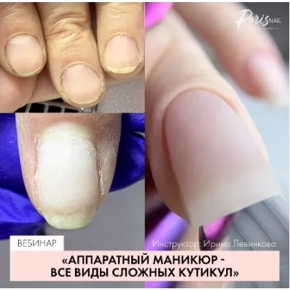 Скачать курс «[Parisnail] Аппаратный маникюр. Все виды сложной кутикулы (Ирина Левинкова)» — слив курса