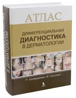 Скачать курс «Дифференциальная диагностика в дерматологии. Атлас (Пол Шнайдерман, Марк Гроссман)» — слив курса