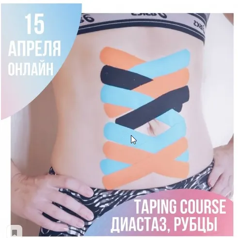 Скачать курс «Диастаз, рубец, слабость пупочного кольца (грыжа). Тейпирование (Екатерина Невзорова  mavikatte)» — слив курса