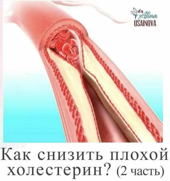 Скачать курс «Как снизить плохой холестерин? 2 часть (Алина Усаинова)» — слив курса