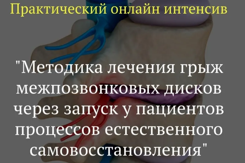 Скачать курс «Методика лечения грыж межпозвонковых дисков  (Игорь Атрощенко)» — слив курса