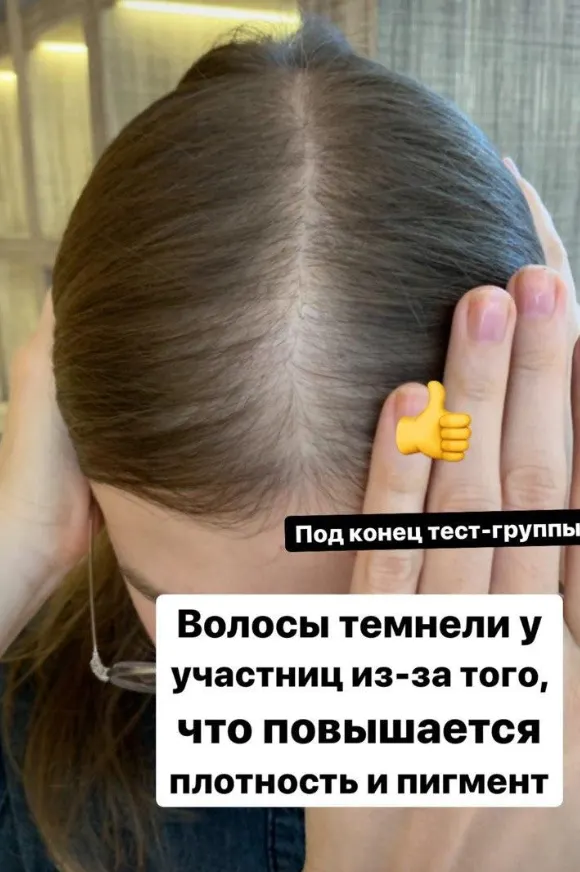 Скачать курс «Волосы - выпадения и алопеции (Елена Корнилова)» — слив курса
