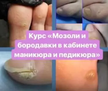 Скачать курс «Мозоли и бородавки в кабинете маникюра и педикюра (Агата Черная)» — слив курса