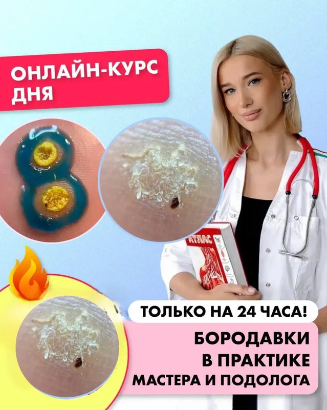 Скачать курс «[ParisNail School] Бородавки в практике мастера и подолога (Ангелина Нышонкова)» — слив курса