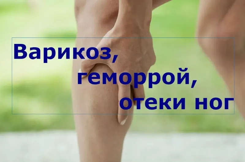 Обложка курса «Многомерная медицина. Варикоз, геморрой, тромбофлебит (Баян Якупова)»