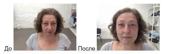 Скачать курс «Биомеханика старения лицевых мышц. Самомассаж (Татьяна Шубина)» — слив курса