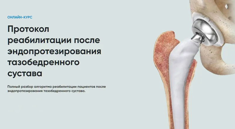 Скачать курс «[Rehab Science] Протокол реабилитации после эндопротезирования тазобедренного сустава (Андрей Богатырев)» — слив курса