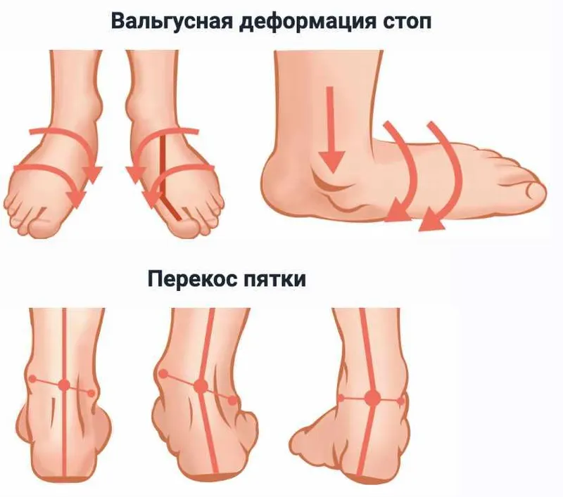 Скачать курс «Стопа. Инструкция по применению» — слив курса