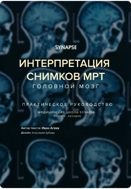 Скачать курс «[Synapse] Расшифровка снимков МРТ. Головной мозг. Практические пособие (Иван Агеев)» — слив курса