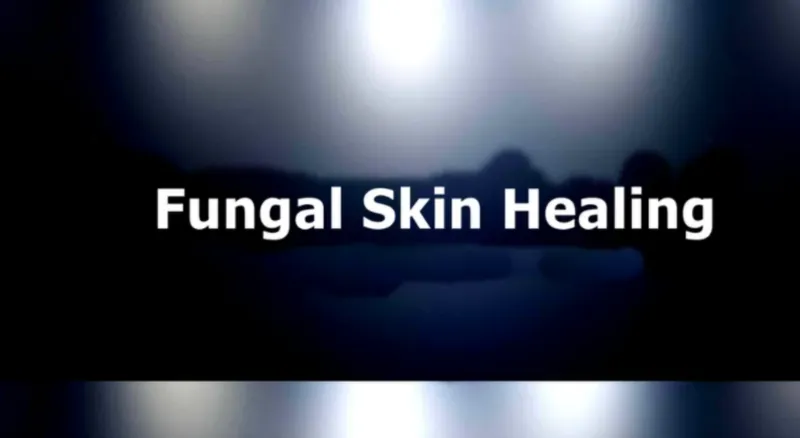 Скачать курс «[Sigh Energy] Грибковое заживление кожи. Fungal Skin Healing Powerful Plus +11x (Extra Strong)» — слив курса