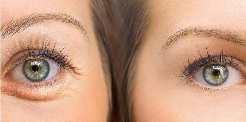 Скачать курс «[Sigh Energy] Восстановление кожи глаз | Eyes skin restoration Powerful Plus +11x(Extra Strong)» — слив курса