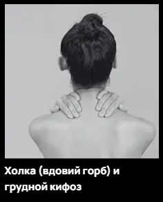 Скачать курс «Холка - вдовий горб и грудной кифоз (Александр Волоткевич)» — слив курса