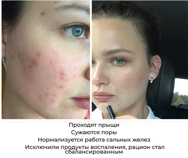 Скачать курс «4 шага к красивой коже (Ксения Чёрная)» — слив курса