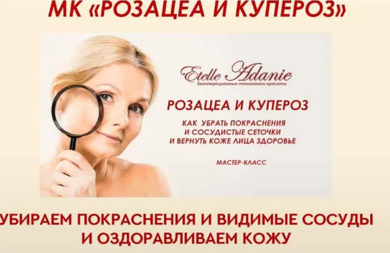 Скачать курс «Розацеа и Купероз. Тариф - Розацеа + Купероз (Этель Аданье)» — слив курса