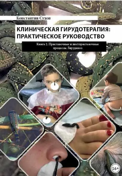 Скачать курс «Клиническая гирудотерапия: практическое руководство. Книга 2 Приставочные и постприставочные процессы. Гирудиноз (Константин Сухов)» — слив курса
