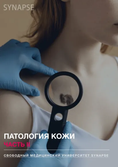 Скачать курс «[Synapse] Методичка по патологии кожи. Часть II» — слив курса