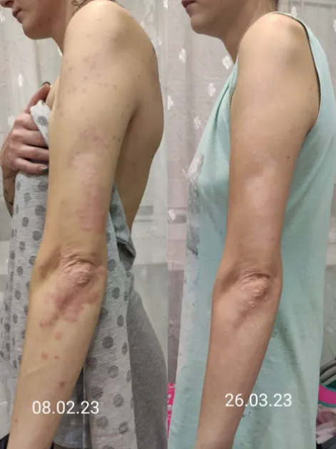 Скачать курс «Легендарный прочистон (Алёна Ковальчук)» — слив курса